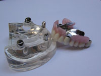 Denture002